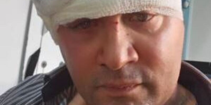 L'aggressione subita da Sibilia