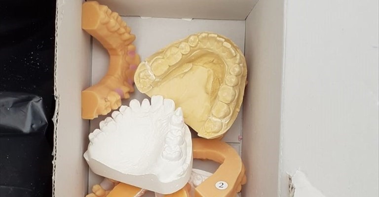 i calchi di dentiere abbandonati