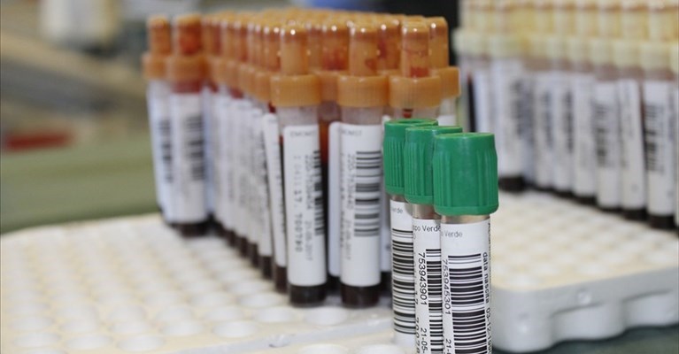 Il centro prelievi Canova