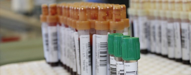 Il centro prelievi di Galluzzo cambia orari