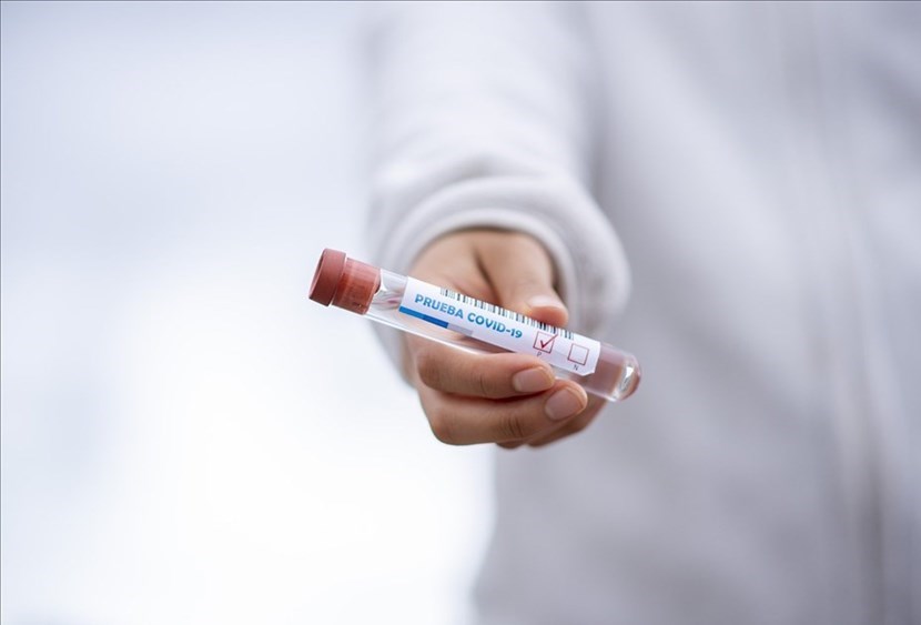 Tampone Coronavirus