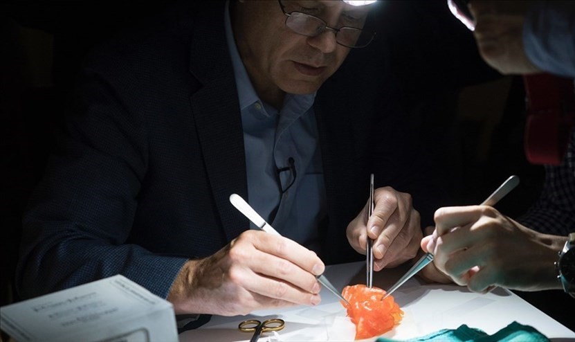 Modello medico stampa 3D