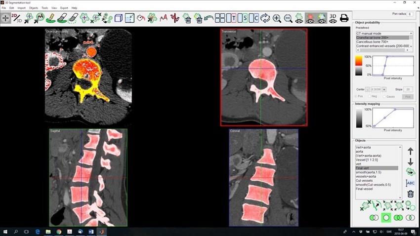 Il futuro della medicina è nella stampa 3D, nasce a Firenze un centro italiano di eccellenza