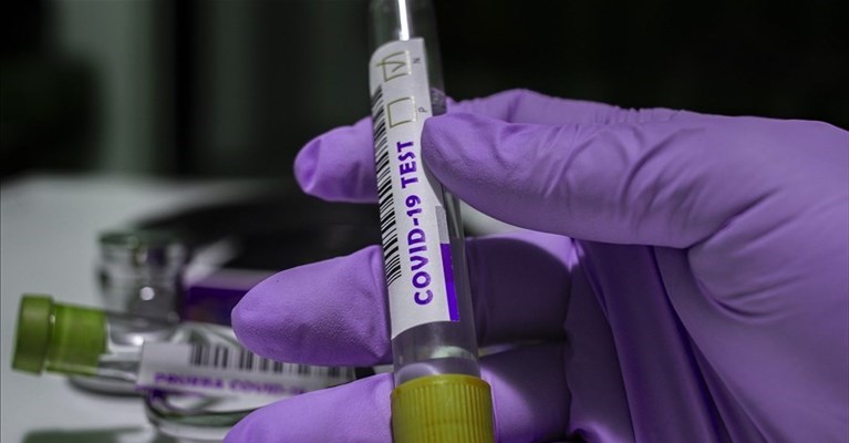 test facile e a casa