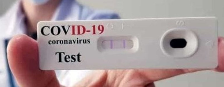 Test antigenico rapido Covid - 19
