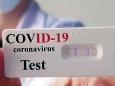 Test antigenico rapido Covid - 19