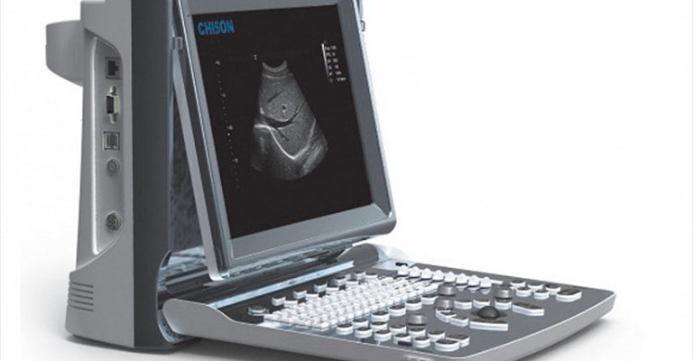 ecografo portatile