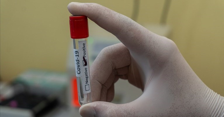 i dati odierni del contagio