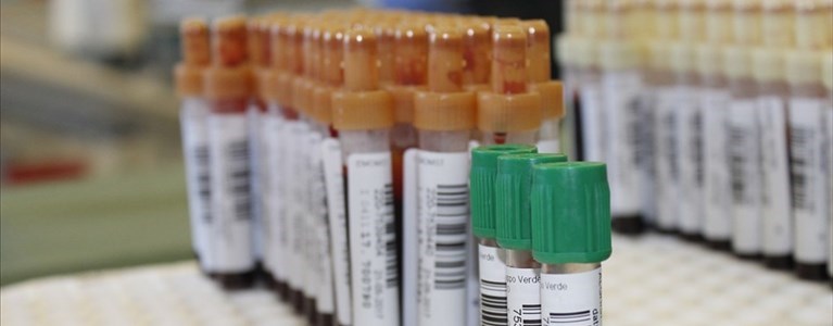 Il centro prelievi DellaPiccola chiuso da oggi