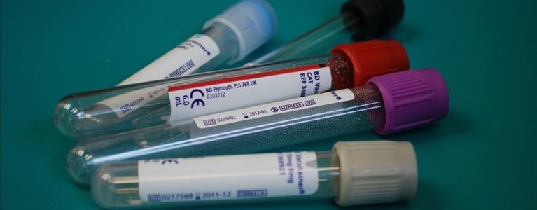 Prelievi sangue