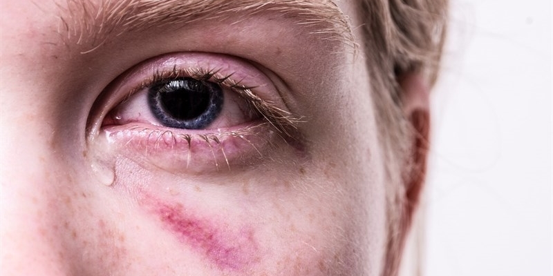 violenza sulle donne