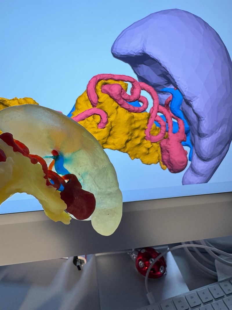 Parte della stampa £d