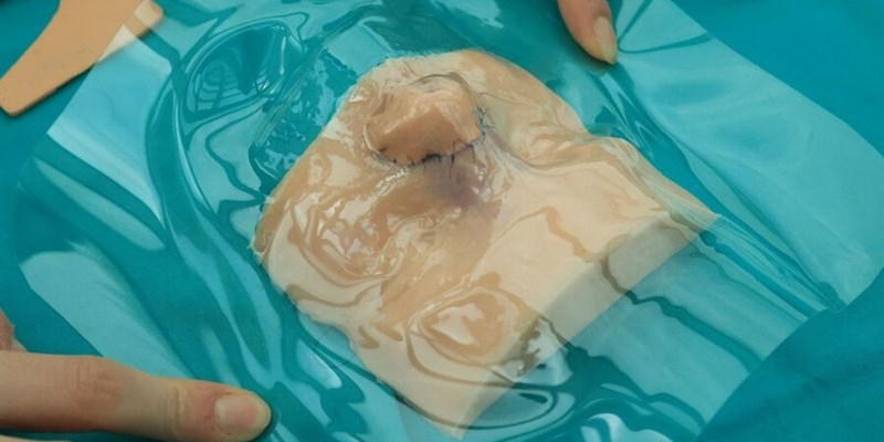 Modello stampato in 3D della scansione del volto del bambino, preparazione intervento ricostruzione nasino